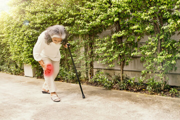 Elderly asian woman aching knee with osteoarthritis during walking : Knee injury Inflammation is...