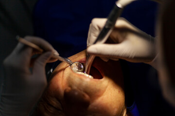 Close up dental examination and treatment, dental cleaning, dental instrument, hygienic dental