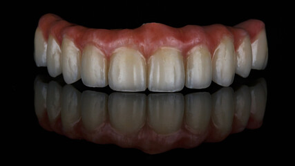 composition of dental prosthesis of the upper jaw on black glass with creative reflection © Dental Pro Content