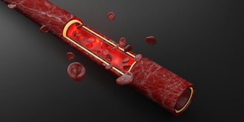 red blood cells skin layer veins 3d illustration intravascular surgery