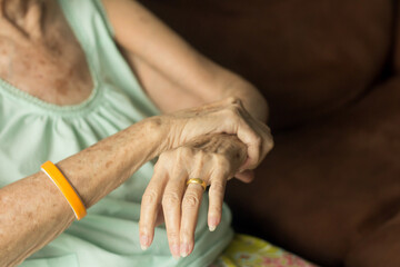 Old woman with symptoms Guillain-Barré syndrome (GBS) often presents with numbness of the hands.