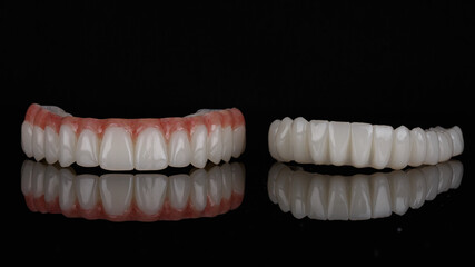 Set of temporary dentals of prostheses from high quality materials on black glass and reflection
