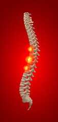 3d rendered illustration of human spine