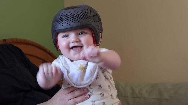 Baby girl wearing a cranial remoulding helmet for flat head