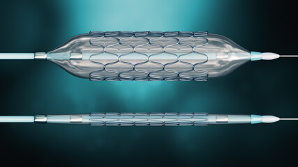 Deployed and collapsed stent ready for angioplasty on a blue background 3D rendering illustration. Medical, surgery, cardiology, medicine, science, technology, healthcare concept.