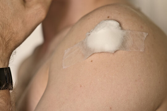 Closeup view of young man's arm being vaccinated with a COVID-19 vaccine. Injection site covered with wadding and plaster. Dublin, Ireland