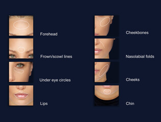 dermal filler treatments .Hyaluronic acid injections for specific areas.Correct wrinkles.