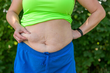 Overweight woman pinching the excess fat on her stomach