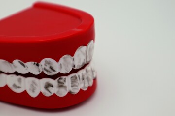 不衛生な歯のイメージ