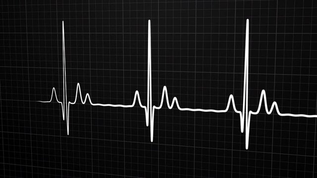 Loopable: White 3D EKG/ECG cardiogram oscilloscope monitor heartbeat line chart shows 60 BPM heart rate on black background with grid.