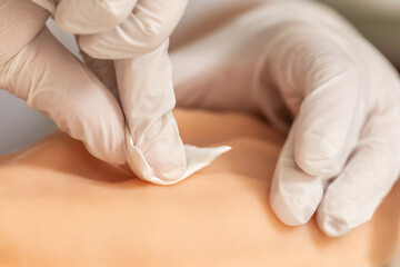 Close-up of a person disinfecting a small skin area with a swab to prepare it for an injection