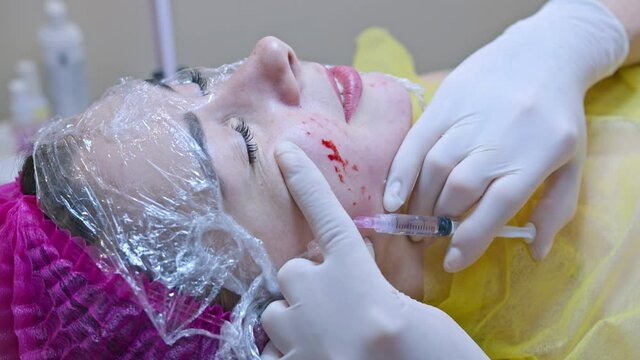 Beauty and injection concept. Cosmetology in the clinic. An experienced beautician wearing white gloves injects a subcutaneous injection with the necessary active ingredients into a woman's face for