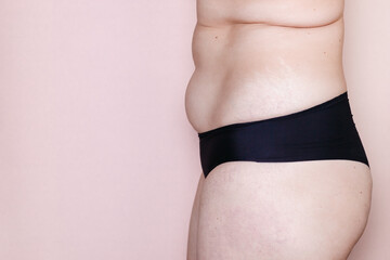 woman with her belly with stretch marks pink background