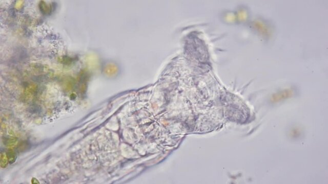 Rotifer colony under microscope. Stunning micro world with lot of microorganisms
