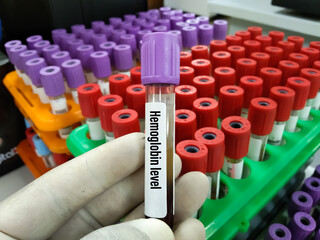 Doctor holding blood sample tube ForCBC, Hemogram,HCT, MCV Hematrocrit,MCH, Total count of WBC...