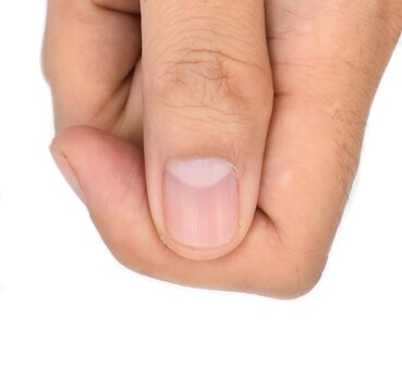 Thumb nail images deals