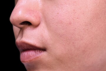 Fair skin with wide pores in face of Southeast Asian, Myanmar or Korean adult young man.