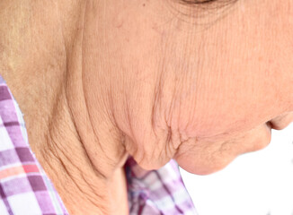 Aging skin folds or skin creases or wrinkles at neck of Asian, Chinese elderly woman.