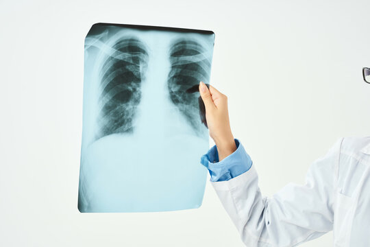 x-ray of the lungs close-up examination light background
