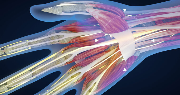 Carpal tunnel syndrome, carpal tunnel syndrome, median nerve entrapment and inflammation, hand anatomy, neurons, body tissues, 3D illustration