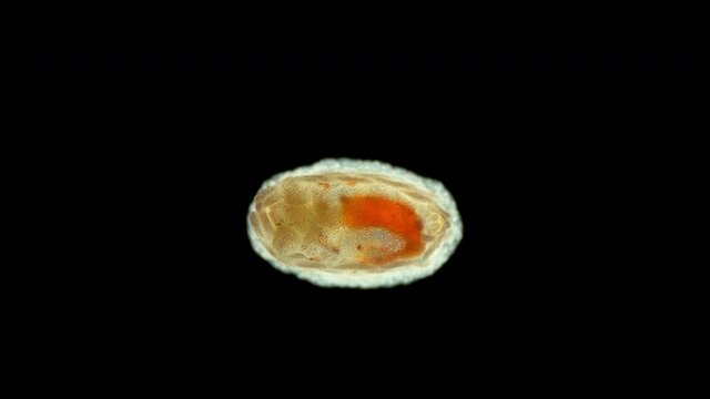 Pentacula Holothuroidea larva, Juvenile sea cucumber under microscope, type Echinodermata, a very unusual organism, at this stage, she sank to bottom and crawled in search of food. Barents Sea