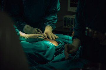 Asian Medical Team Performing Surgical Operation in Modern Operating Room. Doctors and Nurse in green uniform concentrate working in the hospital