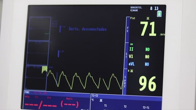 Monitor de electrocardiograma en estado critico en cirugía  medica