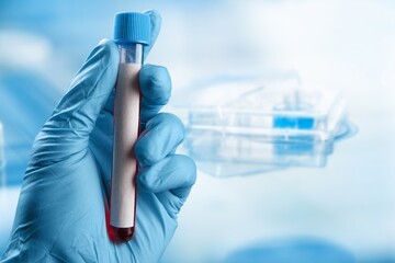 Coronavirus.