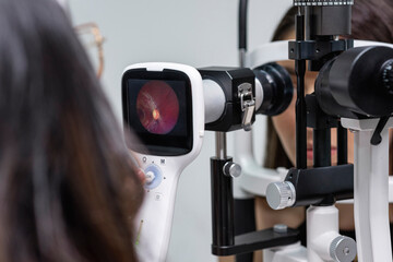 Doctora medico de la salud visual realizando un fondo de ojo con cámara retiniana 