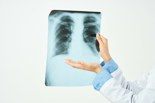x-ray of the lungs close-up examination light background