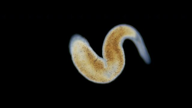 A flatworm of the Monocelididae family under a microscope, possibly of the genus Monocelis. Sample found in the Barents Sea