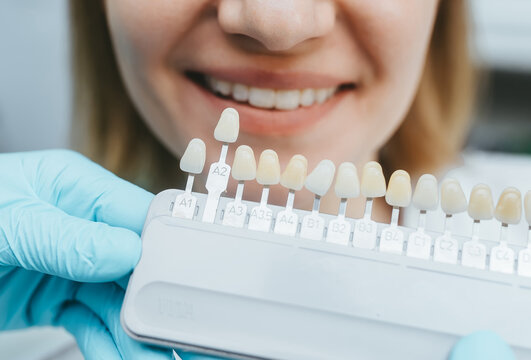 Closeup of a smiling woman matching the shades of the implant teeth