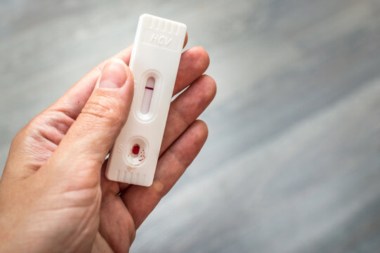 Woman Holds A Test For Hepatitis C In Her Hands. Express Test At Home