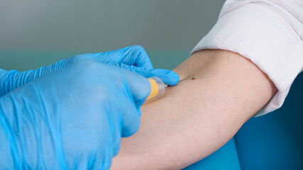 Obraz premium Skilled nurse in blue gloves takes blood specimen from man patient vein with syringe in contemporary hospital office extreme close view