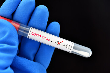 Nasopharyngeal swab negative with COVID-19 test by using antigen test kit, rapid test method 