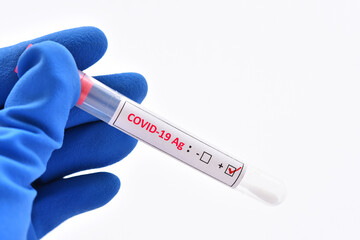 Obraz premium Nasopharyngeal swab positive with COVID-19 test by using antigen test kit, rapid test method
