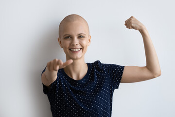 Cheerful young hairless after chemotherapy ill woman pointing finger at camera, showing strong...