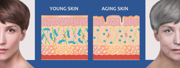 The diagram of younger skin and aging skin