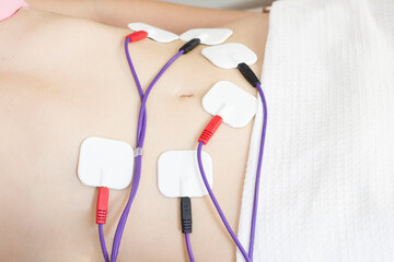 Physical therapy of the abdomen with the help of electrode pads, percutaneous electrical stimulation of the nerves.