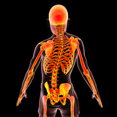 Scoliosis, 3D illustration. Spine curve anatomy - obrazy, fototapety, plakaty