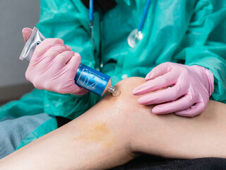 Doctor in gloves, close-up smears anesthetic ointment on knee injury in clinic.