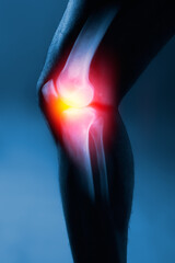 Human knee joint and leg in x-ray on blue background. The knee joint is highlighted by yellow red...