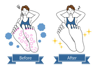 スキンケア 水虫 足裏のお肌トラブルのビフォーアフター 可愛い男性のイラスト シンプル ベクター