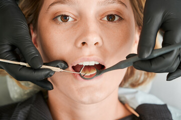 Close up of stomatologist hands checking female patient teeth. Young woman with open mouth looking...
