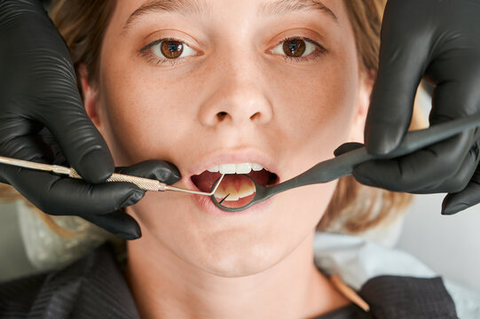 Close up of stomatologist hands checking female patient teeth. Young woman with open mouth looking at camera while having prophylactic examination in dental clinic. Concept of dentistry.