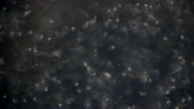 Mechanical stage microscope pans across sperm cells.