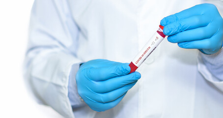 Doctor holding a test blood sample tube positive with delta variant or strain COVID-19.