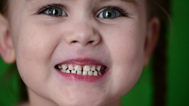 The girl shows her baby teeth, white baby teeth, oral hygiene, slow movement of the child.