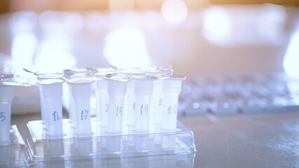 Covid-19 test kit Antigens, rapid detection placed on the table. Fast and large virus detection.