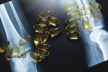 X-ray image and capsules of fish or krill oil